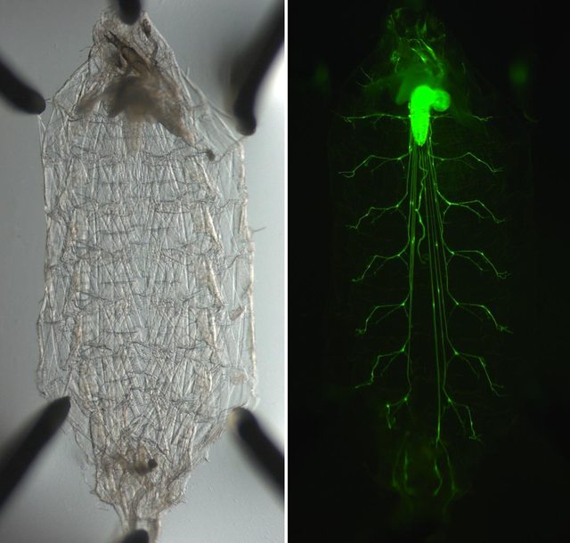 GFP expressing motor neurons in Drosophila larvae. I did not do this btw.