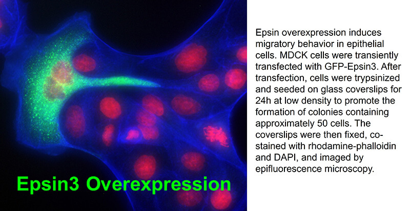 Epside overexpression induces migratory behavior in epithelial cells.