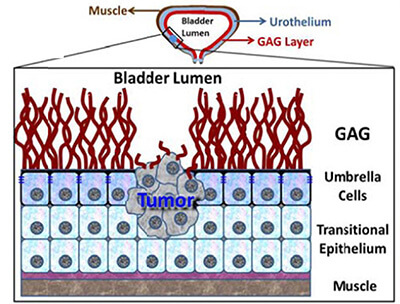 Bladder Lumen