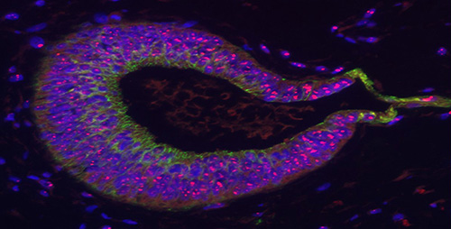 Kidney organoid produced by iPSC generation from patient fibroblasts.