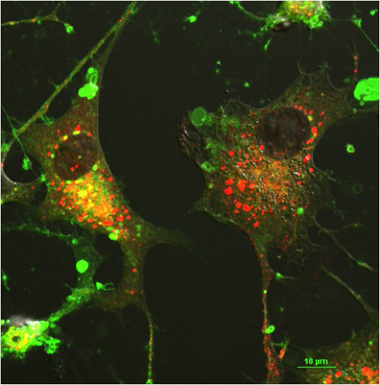 SINV NSP3-RFP Bodipy Stain