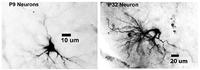 Onset of hearing correlated with rapid refinement of neuron inhibition