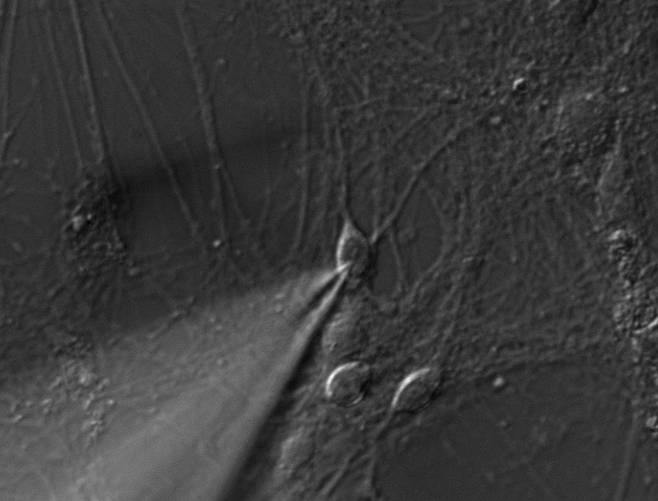 ReidHarrisonNeurons0206140300