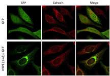 Localization of the HYPE protein in the endoplasmic reticulum of human epithelial cells. HYPE is illuminated with GFP, a green marker, and the endoplasmic reticulum is illuminated with calnexin, a red marker. (Purdue University image/courtesy of Seema Mattoo) 