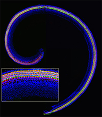 Gene Networks in Cochlear Patterning