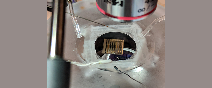 New quantum material could warn of neurological disease
