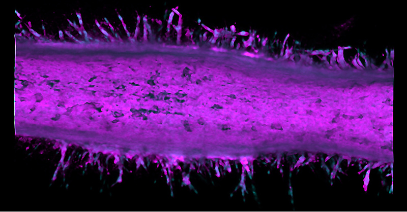 Pancreatic cancer 'time machine’ exposes plot twist in cell growth and invasion